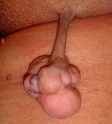 Behandlung - Hautchirurgie und Laser - Ordination Haut im Zentrum Eisenstadt