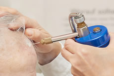 Behandlungen in der Ordination Haut im Zentrum - Eisenstadt